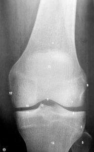 RTG kolana widok przedni