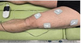 Zabieg EMS dla mięśnia czworogłowego uda